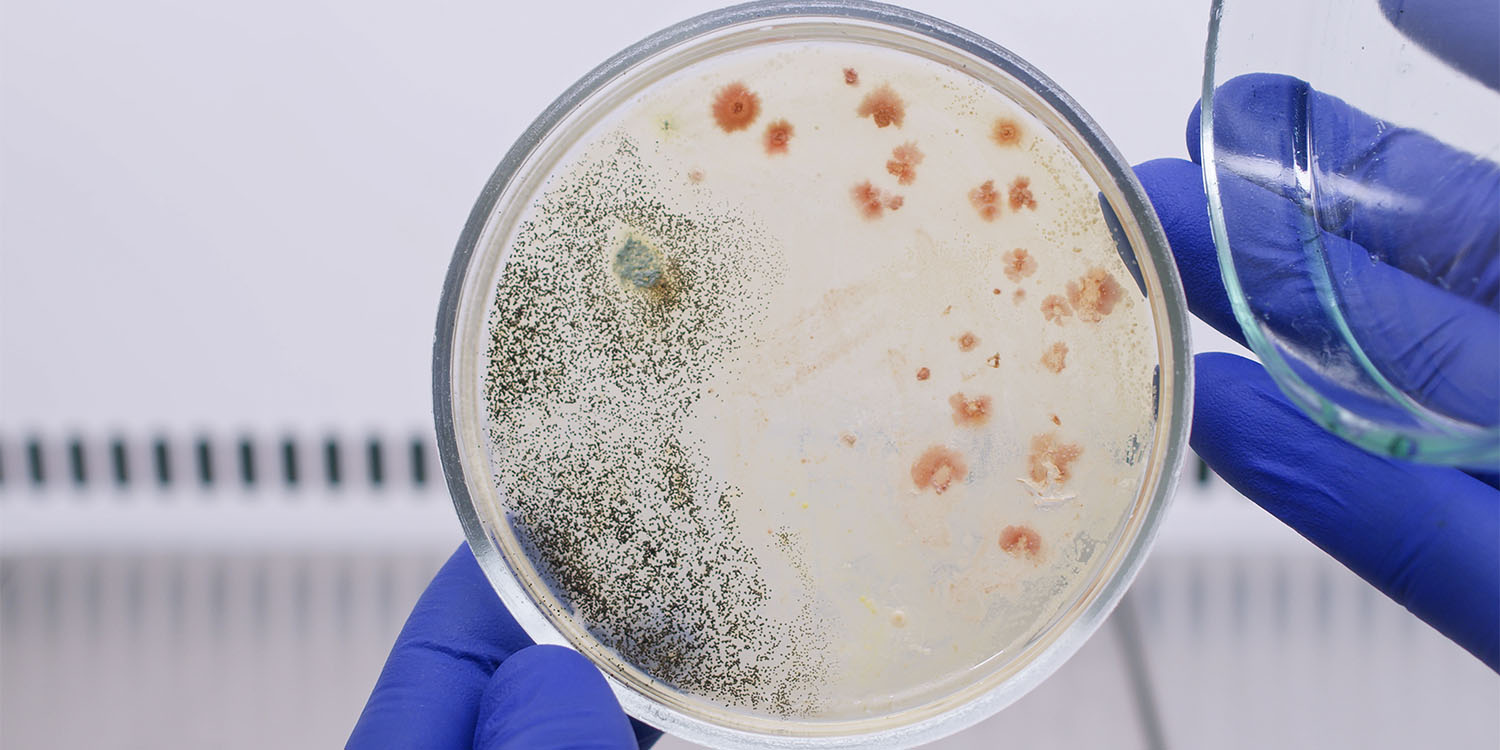 Preventing Mold Growth - AIS Remodeling